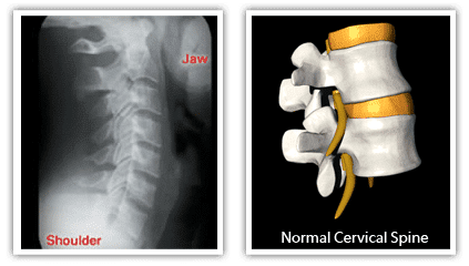 Spine  X-R-A-Y